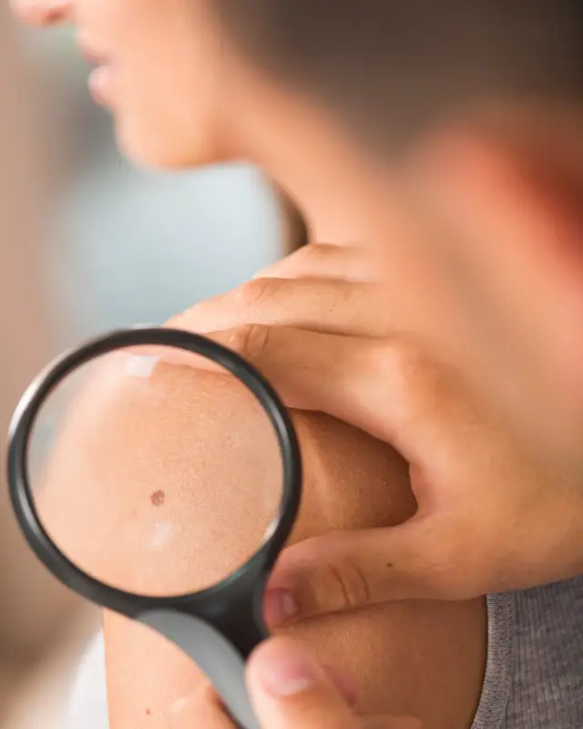 dermatologia